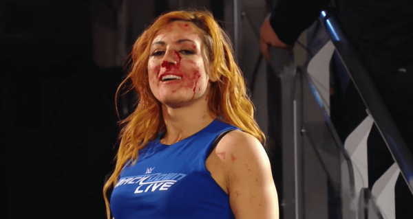 Becky Lynch, la vraie superstar de la WWE